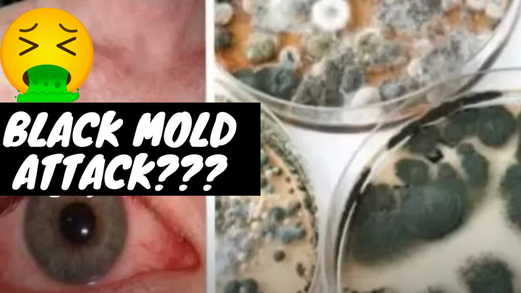black-mold-health-attack